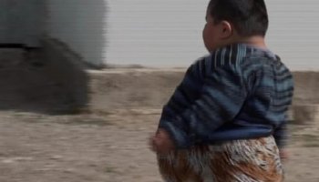 Алматы облысында салмағы 70 келіге жеткен 5 жасар баланың қандай ауруға шалдыққаны белгісіз